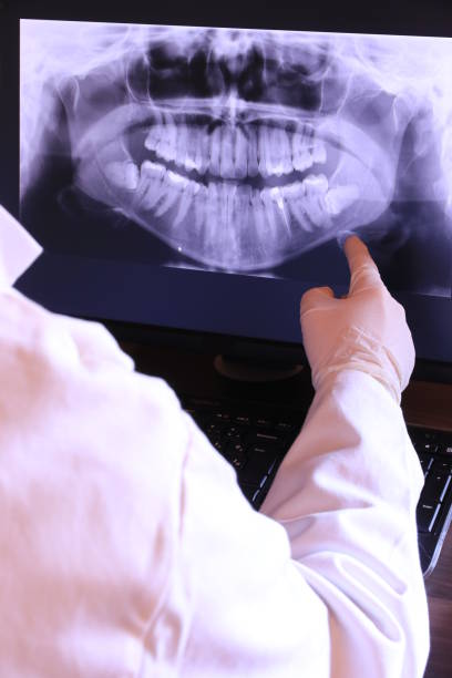 Best Emergency Dental Care for Broken or Chipped Teeth in Pine City, MN