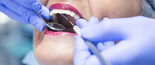 Best Emergency Gum Treatment in Pine City, MN
