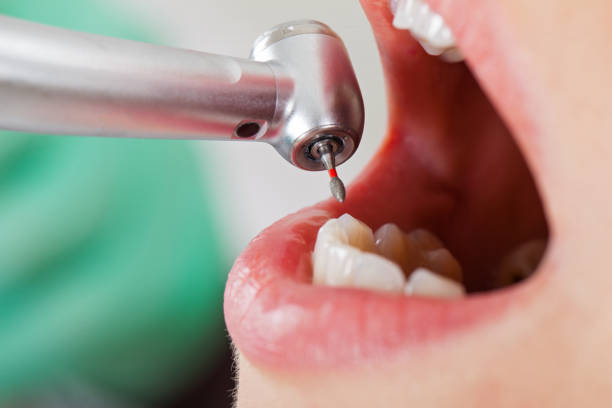 Best Emergency TMJ Treatment in Pine City, MN